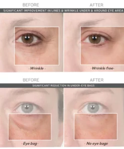 LOVILDS™Instant Wrinkle Eye Tightener Cream