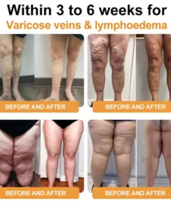 MRESIO™ Ultrasonic Fat Blasting & Far Infrared Blood Sugar Balancing Detox Wristband