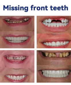 DIYSTARβ’ ππππππππ π·πππ‘π’ππ π
π’πππ πππ‘