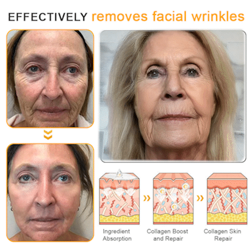 Flysmus™ BeeLift Anti-Aging Firming Cream