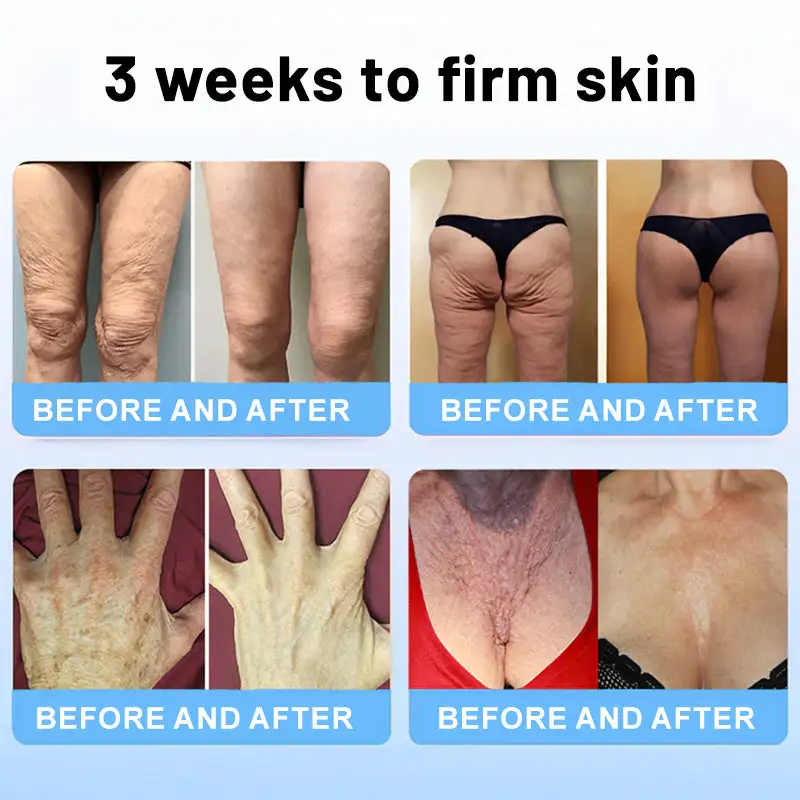 HZA™ Колагенови пептиди СТЯГАЩ СЕРУМ СТИК