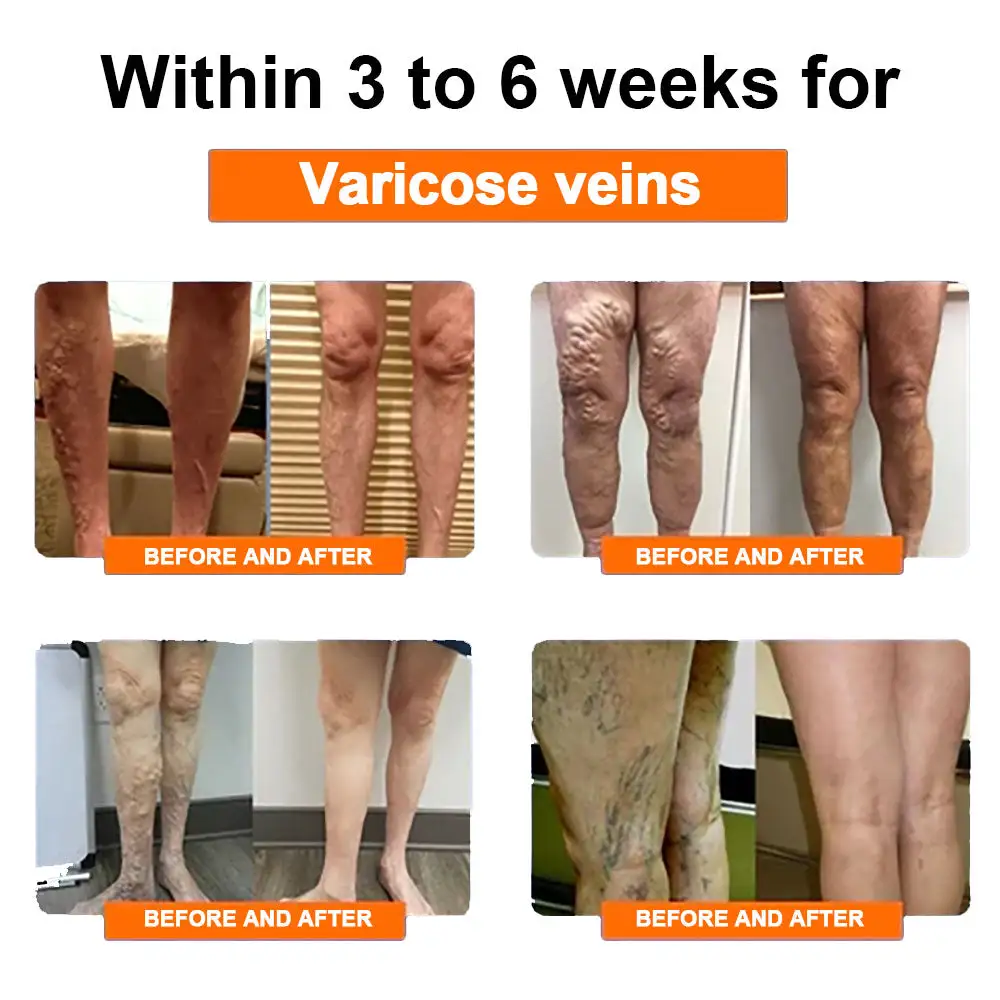 Paiduis™ Radiofrequency Herbal Thermal Knee Support