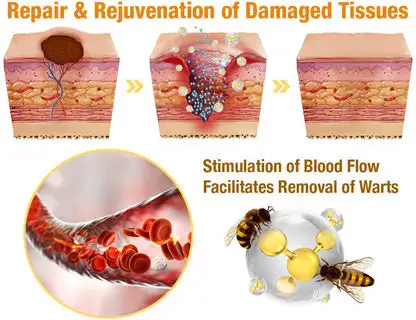 Raindew™ Powerful All-Body Skin Treatment Cream