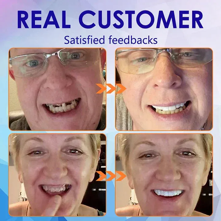 Lekdas™-🦷Advanced Customized Full Denture Set - Image 10