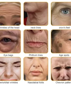 AllyBee™ Skin Treatment Cream