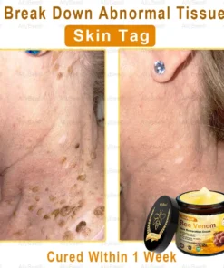 AllyBee™ Skin Treatment Cream