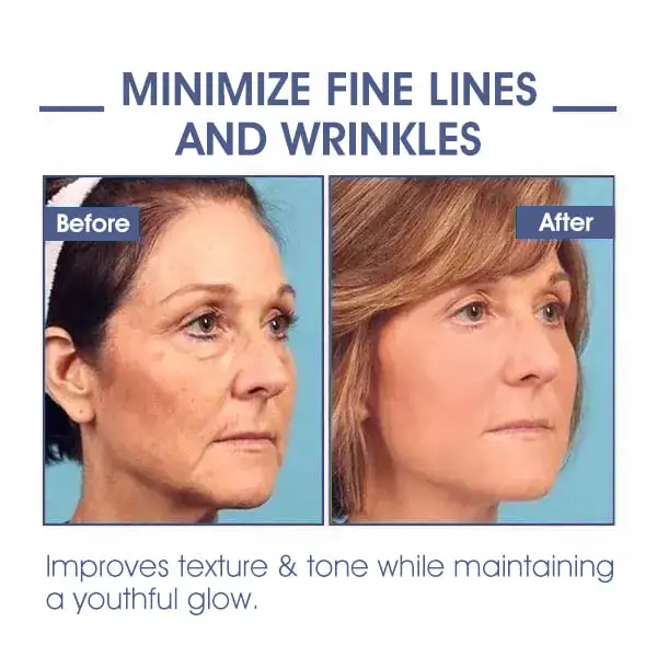 CVREOZ™ Advanced Firming & Wrinkle Reducing Cream