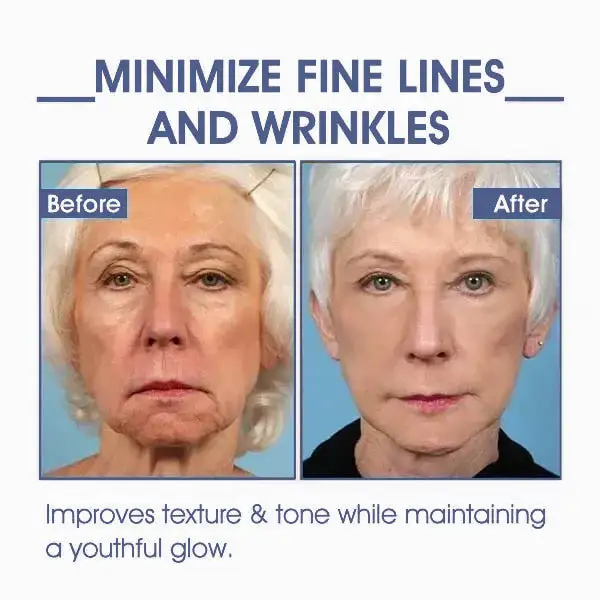 CVREOZ™ Advanced Firming & Wrinkle Reducing Cream