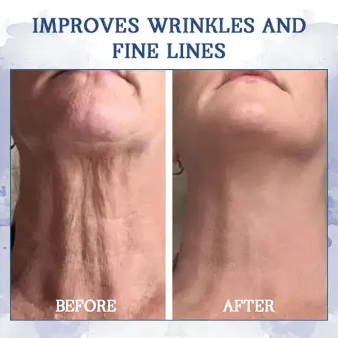 CVREOZ™ Advanced Firming & Wrinkle Reducing Cream