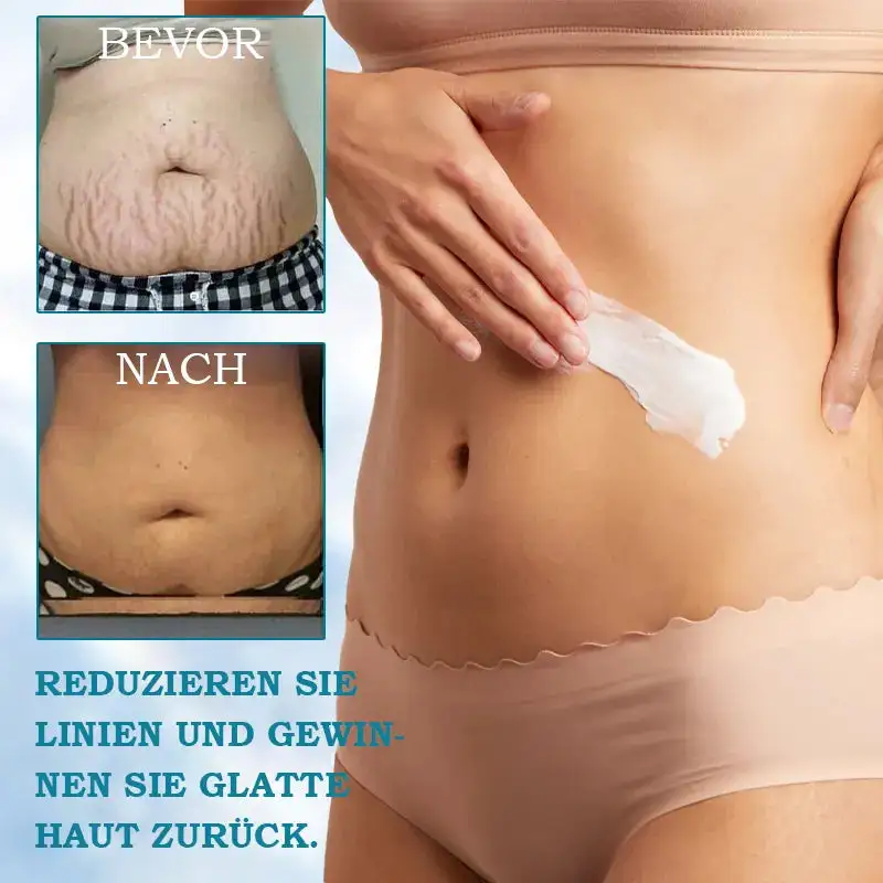 CVREOZ™ Advanced Firming & Wrinkle Reducing Cream