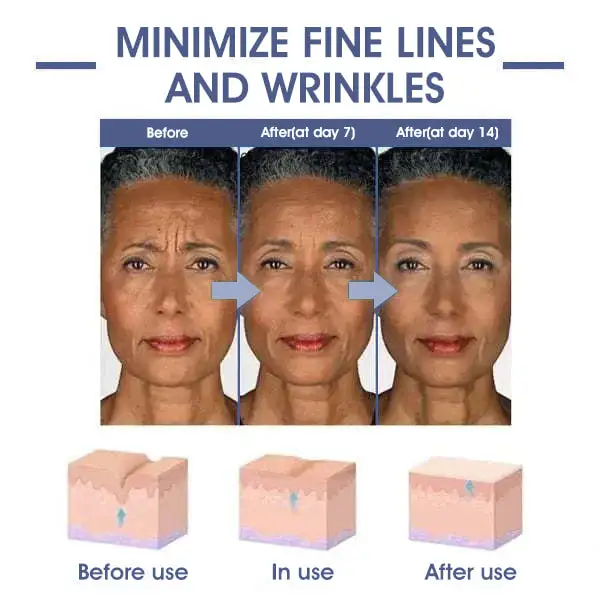 CVREOZ™ Advanced Firming & Wrinkle Reducing Cream