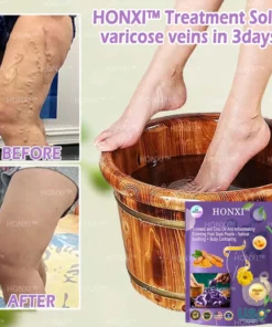 HONXI™ Куркума и масло от ему Противовъзпалителни перли за отслабване на краката