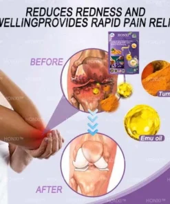 HONXI™ Куркума и масло от ему Противовъзпалителни перли за отслабване на краката