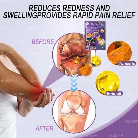 HONXI™ Куркума и масло от ему Противовъзпалителни перли за отслабване на краката