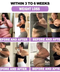 HONXI™ Куркума и масло от ему Противовъзпалителни перли за отслабване на краката