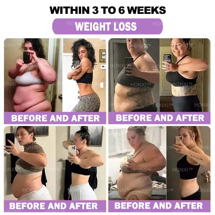 HONXI™ Куркума и масло от ему Противовъзпалителни перли за отслабване на краката