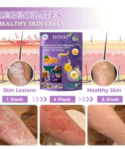 HONXI™ Куркума и масло от ему Противовъзпалителни перли за отслабване на краката