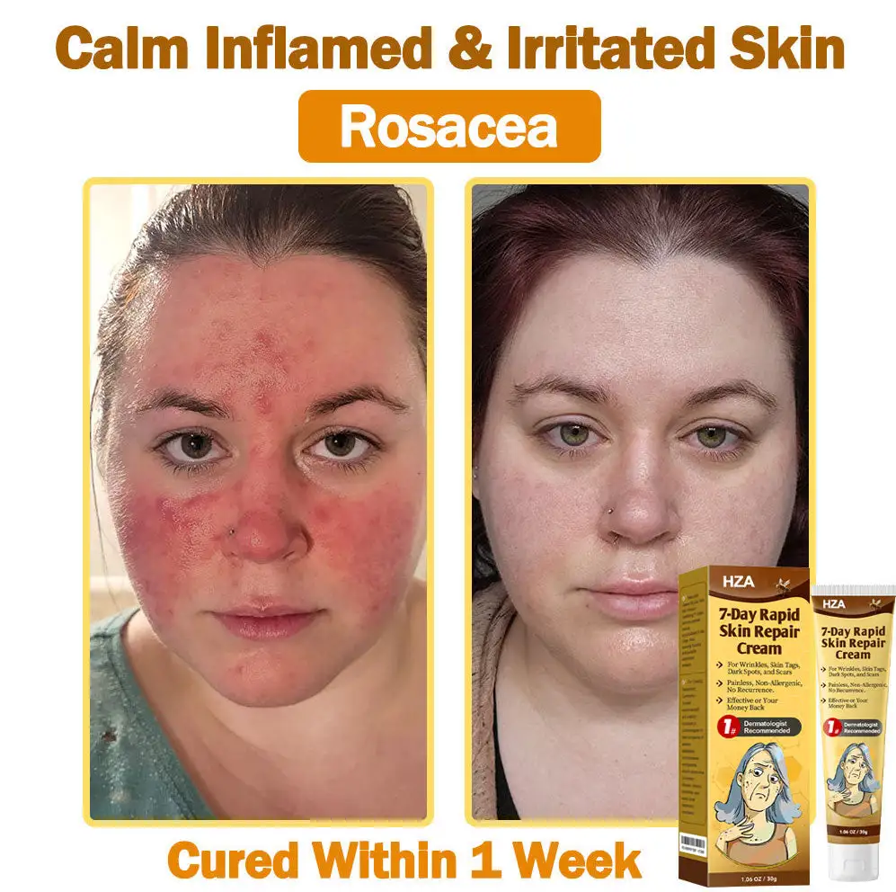 HZA®𝟕-𝐃𝐚𝐲 𝐑𝐚𝐩𝐢𝐝 𝐒𝐤𝐢𝐧 𝐑𝐞𝐩𝐚𝐢𝐫 𝐂𝐫𝐞𝐚𝐦