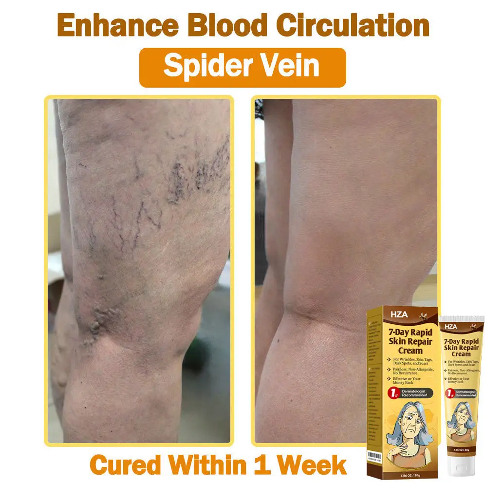 HZA®𝟕-𝐃𝐚𝐲 𝐑𝐚𝐩𝐢𝐝 𝐒𝐤𝐢𝐧 𝐑𝐞𝐩𝐚𝐢𝐫 𝐂𝐫𝐞𝐚𝐦