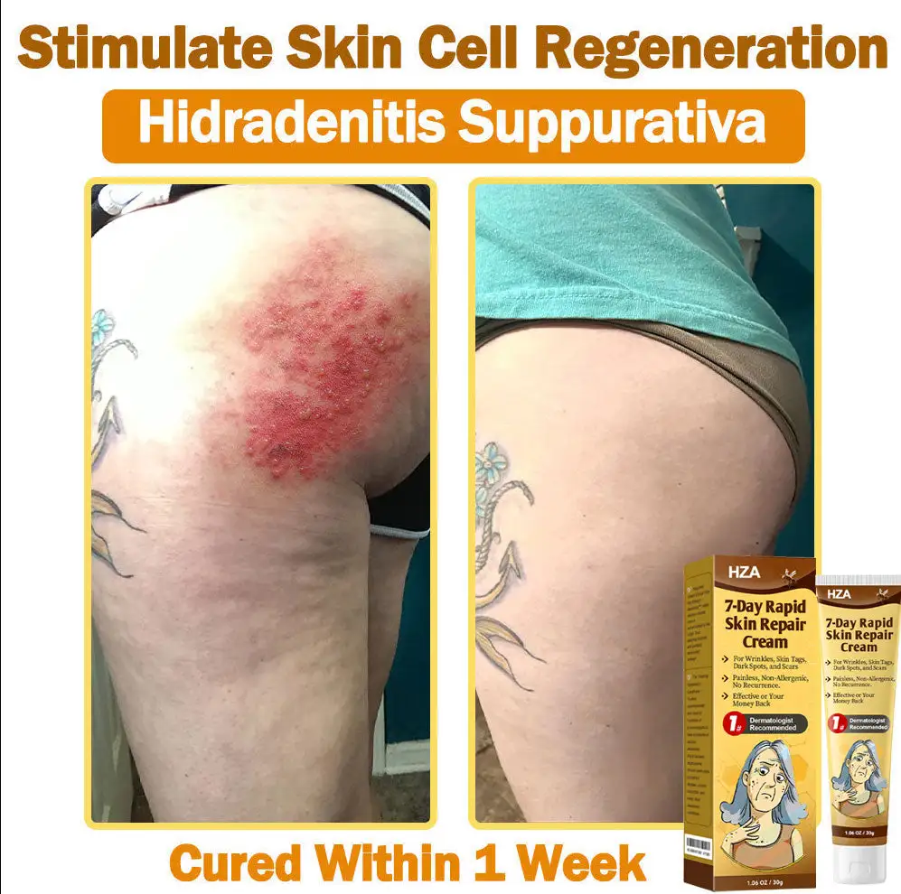 HZA®𝟕-𝐃𝐚𝐲 𝐑𝐚𝐩𝐢𝐝 𝐒𝐤𝐢𝐧 𝐑𝐞𝐩𝐚𝐢𝐫 𝐂𝐫𝐞𝐚𝐦