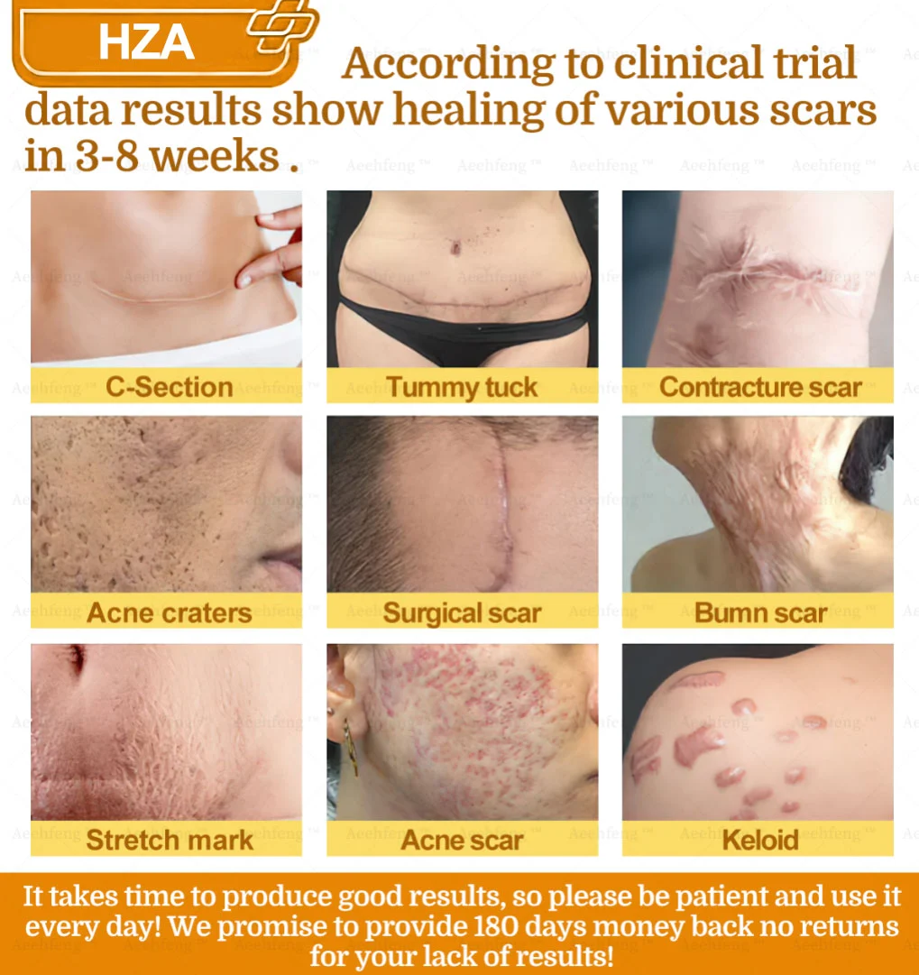 HZA®𝟕-𝐃𝐚𝐲 𝐑𝐚𝐩𝐢𝐝 𝐒𝐤𝐢𝐧 𝐑𝐞𝐩𝐚𝐢𝐫 𝐂𝐫𝐞𝐚𝐦