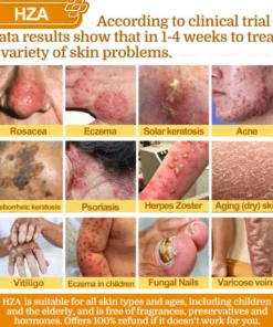 HZA®𝟕-𝐃𝐚𝐲 𝐑𝐚𝐩𝐢𝐝 𝐒𝐤𝐢𝐧 𝐑𝐞𝐩𝐚𝐢𝐫 𝐂𝐫𝐞𝐚𝐦