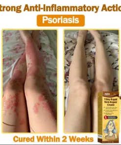 HZA®𝟕-𝐃𝐚𝐲 𝐑𝐚𝐩𝐢𝐝 𝐒𝐤𝐢𝐧 𝐑𝐞𝐩𝐚𝐢𝐫 𝐂𝐫𝐞𝐚𝐦