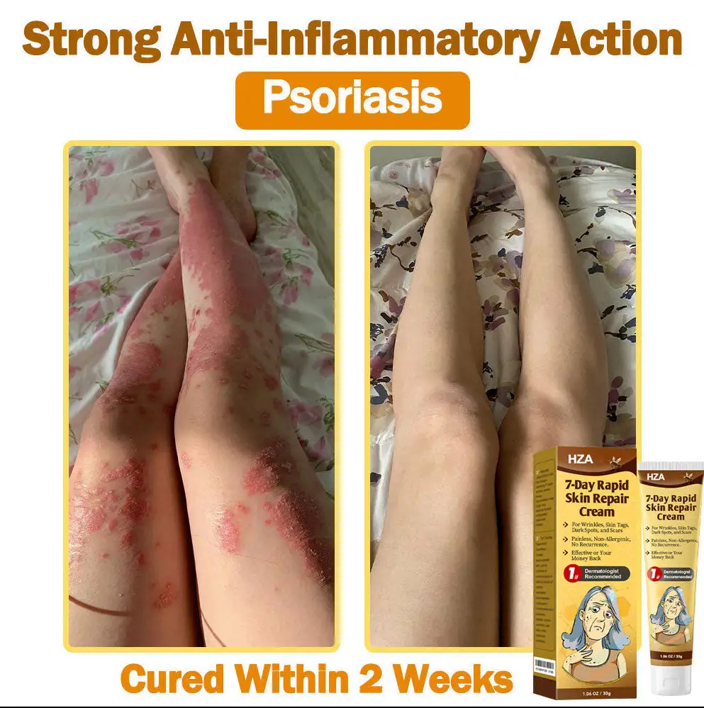 HZA®𝟕-𝐃𝐚𝐲 𝐑𝐚𝐩𝐢𝐝 𝐒𝐤𝐢𝐧 𝐑𝐞𝐩𝐚𝐢𝐫 𝐂𝐫𝐞𝐚𝐦