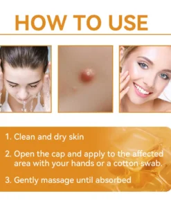 HZA™ Bee Toxin Skin Treatment Cream