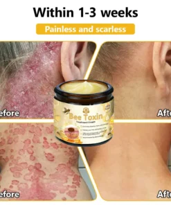 HZA™ Bee Toxin Skin Treatment Cream