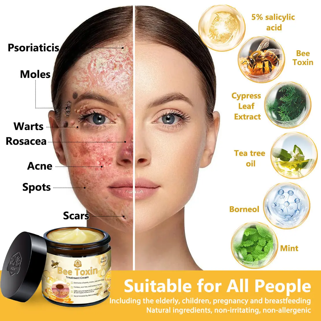 HZA™ Bee Toxin Skin Treatment Cream
