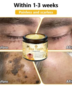 HZA™ Bee Toxin Skin Treatment Cream