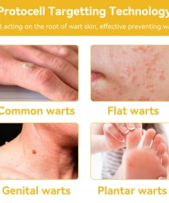 HZA™ Bee Toxin Skin Treatment Cream