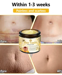 HZA™ Bee Toxin Skin Treatment Cream