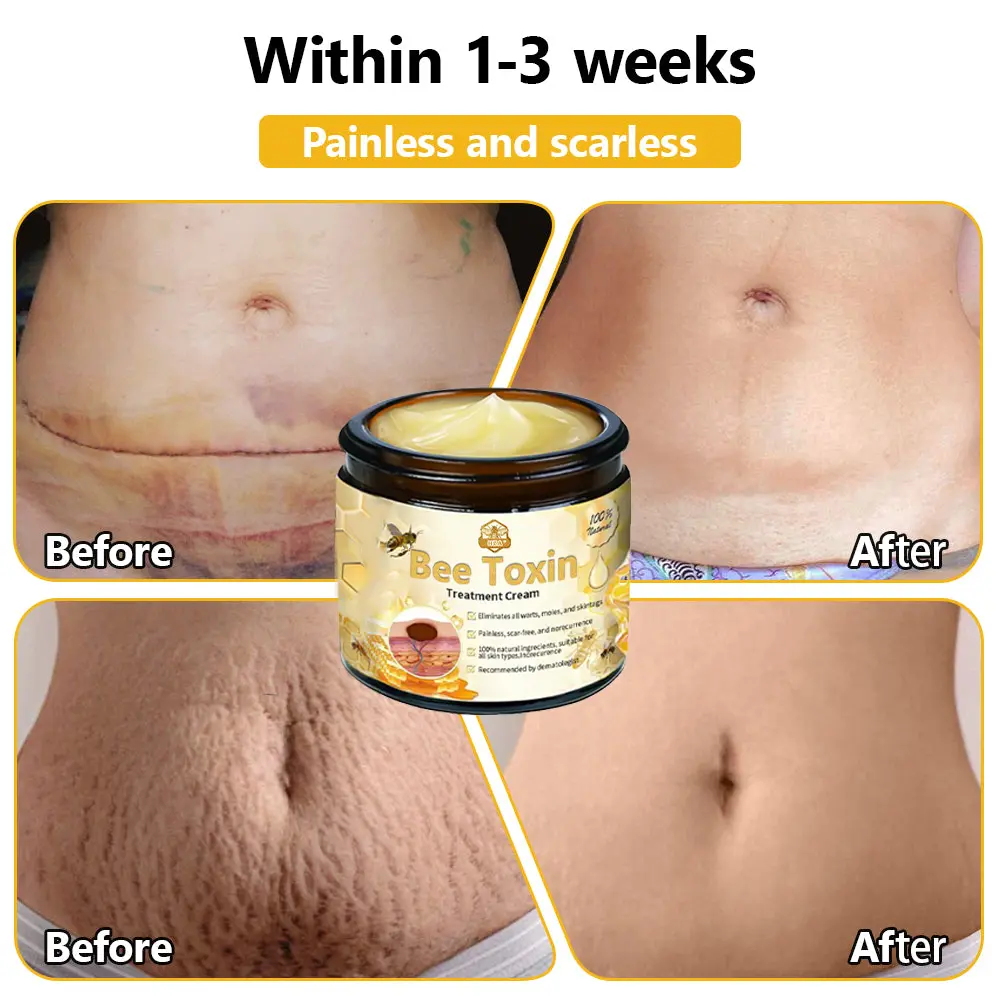 HZA™ Bee Toxin Skin Treatment Cream