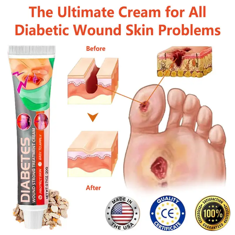 HZA™ Diabetes Wound Strong Treatment Cream