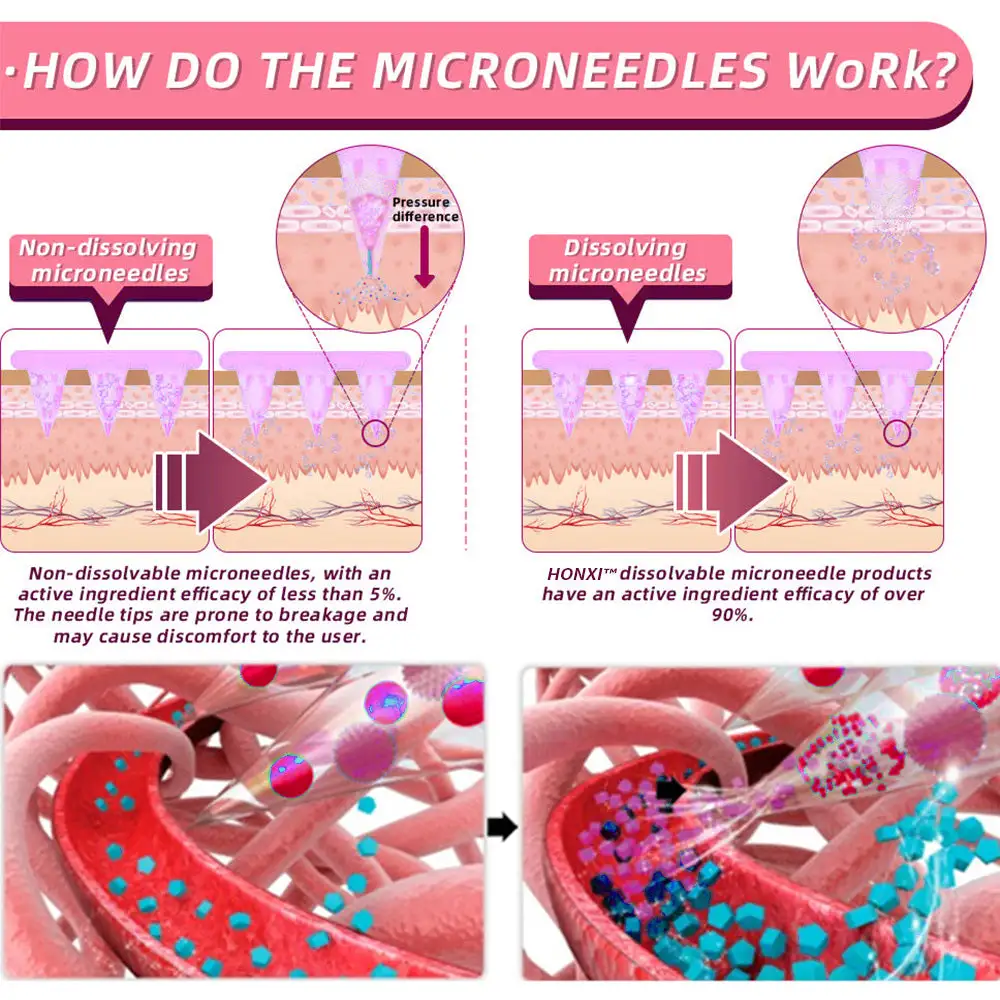 HonXi® Semaglutide Nano Microneedle Slimming Patch