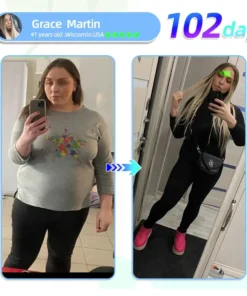 Lmipki® NIDDK-Tirzepatide Nano Microneedle Patch