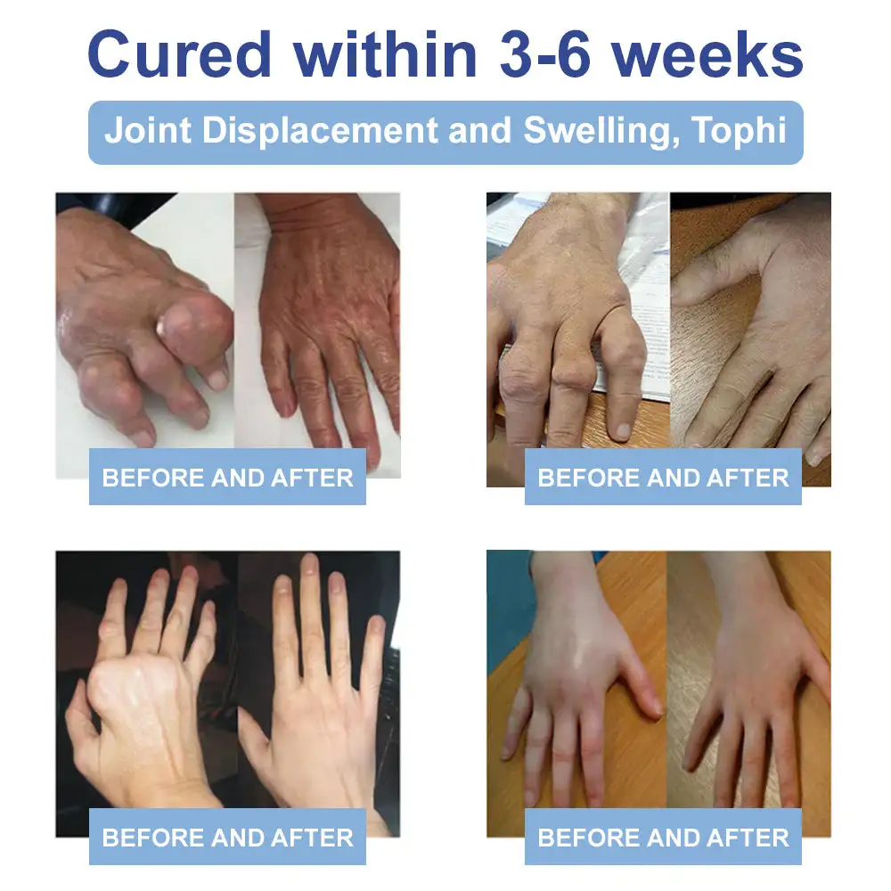 Lotmay™ Magnesium Pain Healing Bone Cream