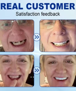 Nurbini™ Advanced Customized Full Denture Set