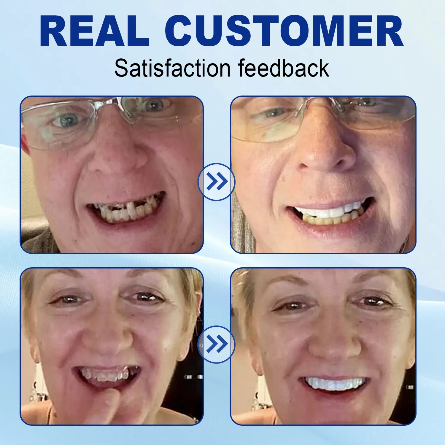 Nurbini™ Advanced Customized Full Denture Set