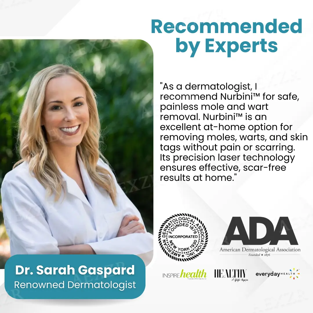 Nurbini® Non-invasive Mole and Wart Removal Laser Pen