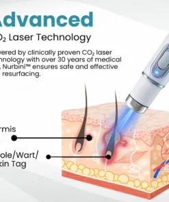 Nurbini® Non-invasive Mole and Wart Removal Laser Pen