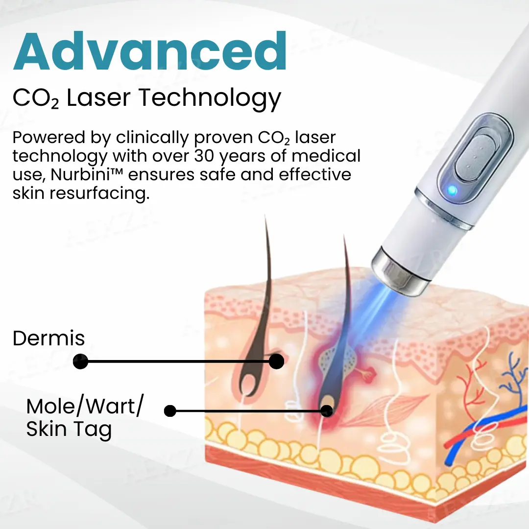 Nurbini® Non-invasive Mole and Wart Removal Laser Pen