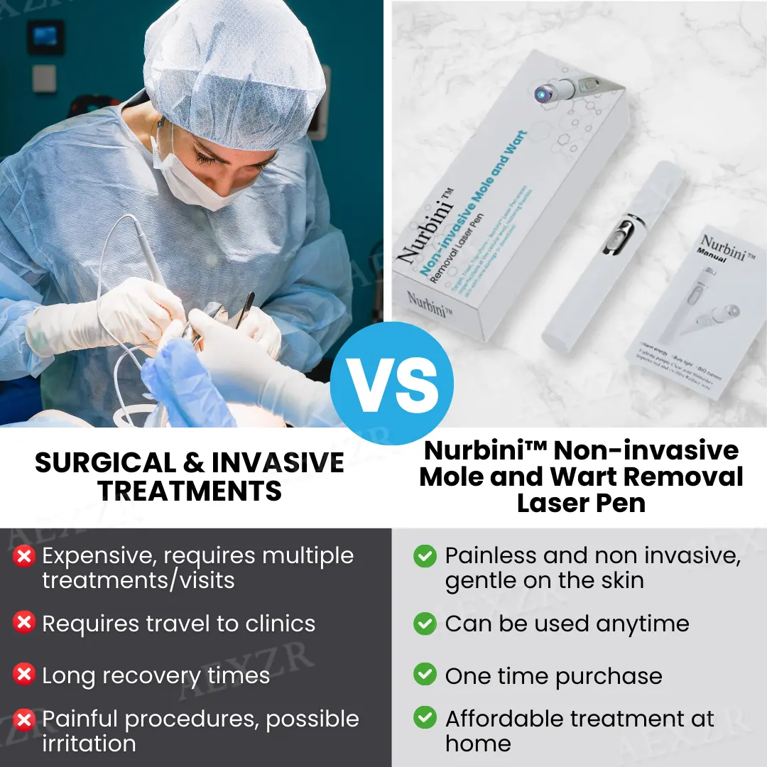 Nurbini® Non-invasive Mole and Wart Removal Laser Pen