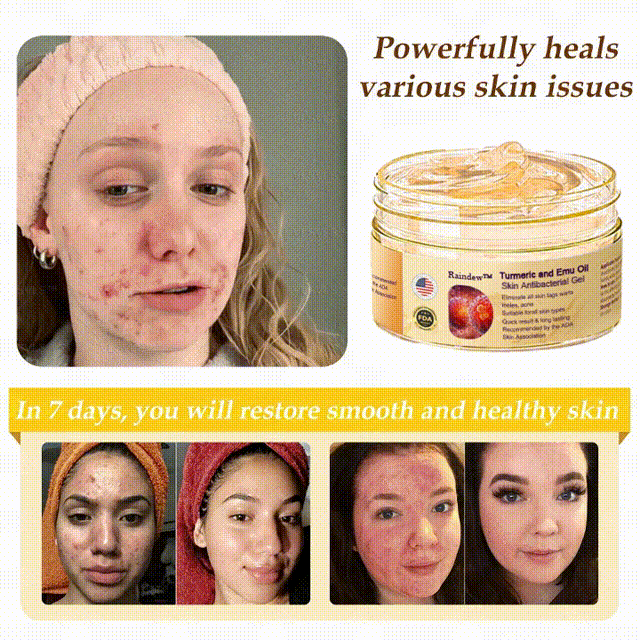 Raindew™ Turmeric and Emu Oil Skin Antibacterial Gel