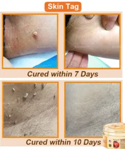 Raindew™ Turmeric and Emu Oil Skin Antibacterial Gel