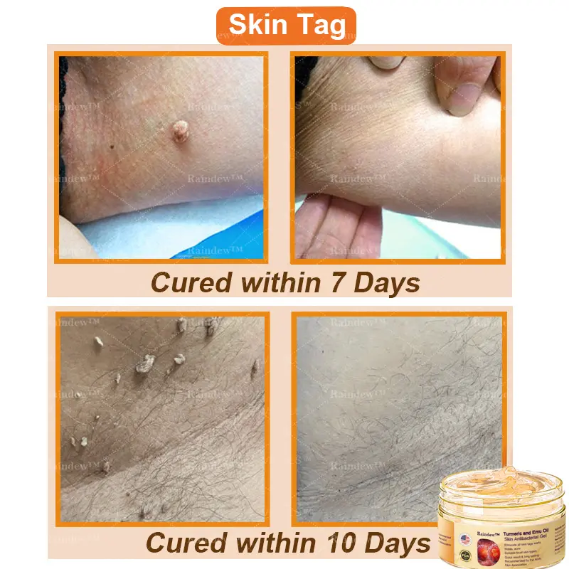 Raindew™ Turmeric and Emu Oil Skin Antibacterial Gel