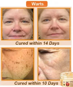 Raindew™ Turmeric and Emu Oil Skin Antibacterial Gel