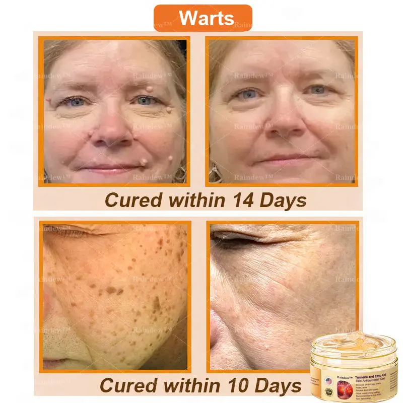 Raindew™ Turmeric and Emu Oil Skin Antibacterial Gel